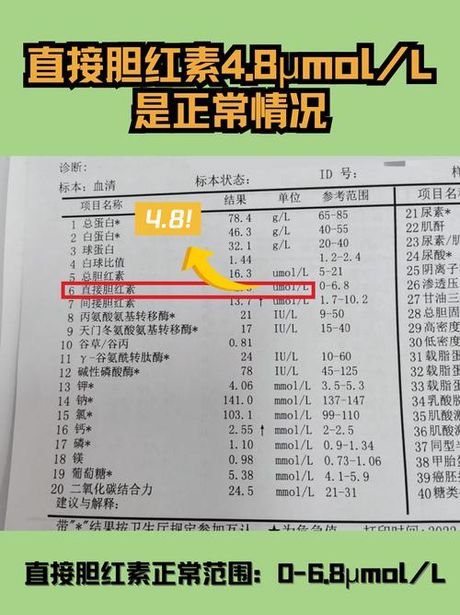 直接胆红素偏高是什么意思？